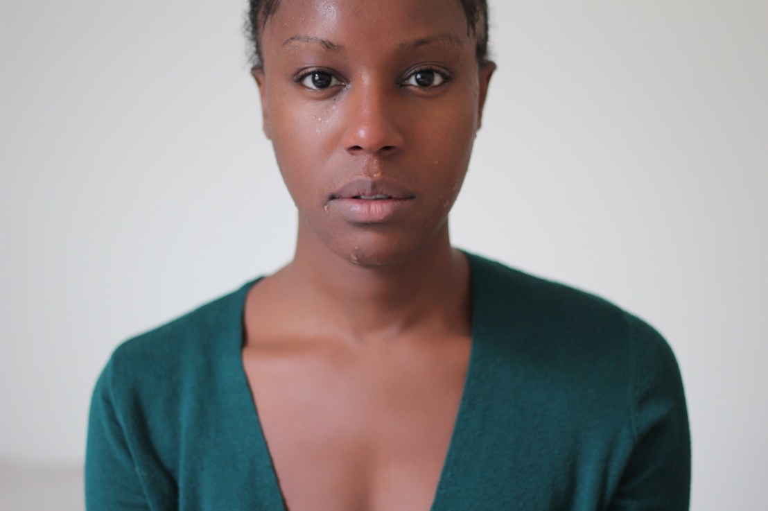 How I manage to take care of my skin disorder (my path to natural healing)